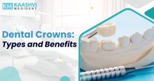 Dental Crowns