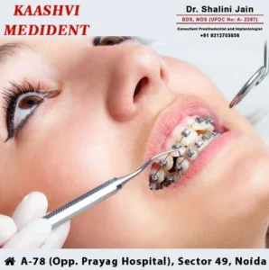 Smile For Your Big Day | Dr. Shalini Jain | Best Dental Clinic in Noida
